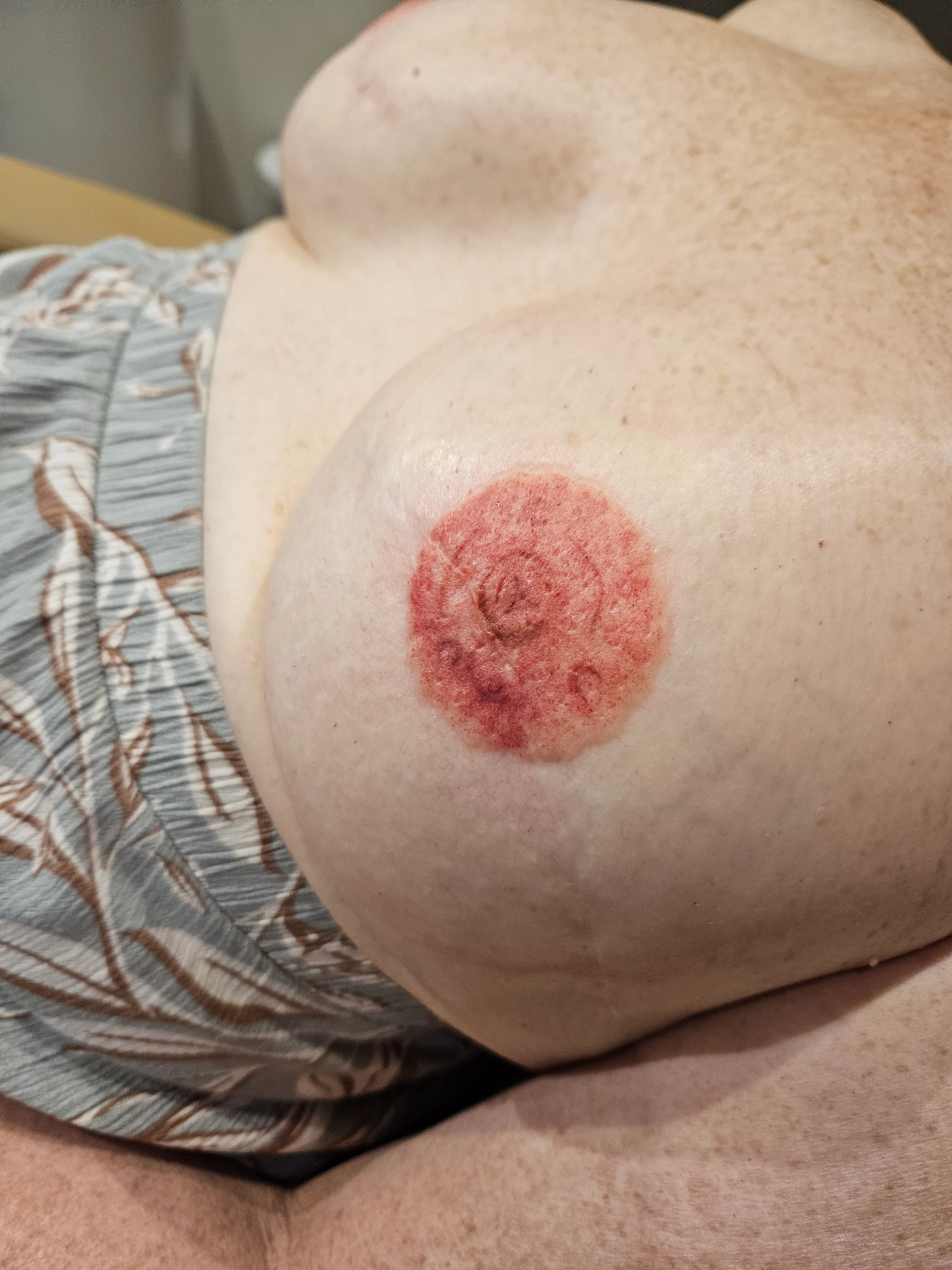 Areola tattoo work, third gallery image